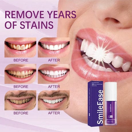 Hismile v34 Color Corrector Serum | HIGH QUALITY | Instant Teeth Brightening Solution | 30ml